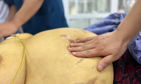 'Phá nát gan' vì sự chủ quan khi mắc viêm gan B