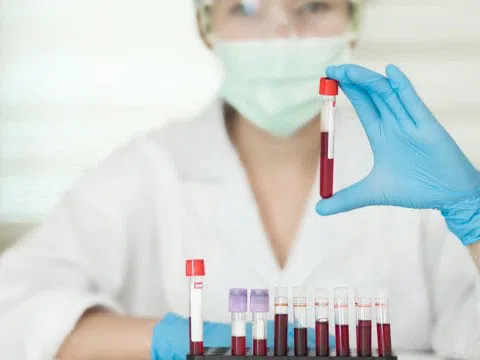 Người thuộc nhóm máu nào dễ có nguy cơ sa sút trí tuệ?