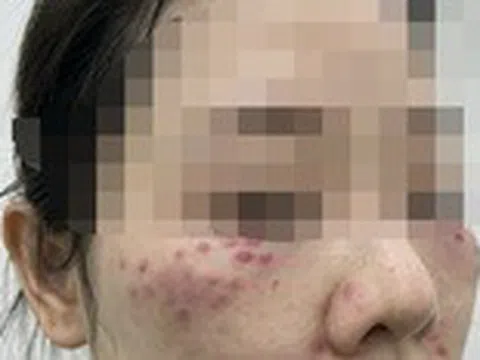 Tế bào gốc làm đẹp: Có phải thần dược để 'nâng cấp' nhan sắc?