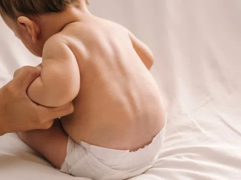 Trẻ nhập viện vì gù cột sống, cha mẹ bất ngờ khi biết lý do